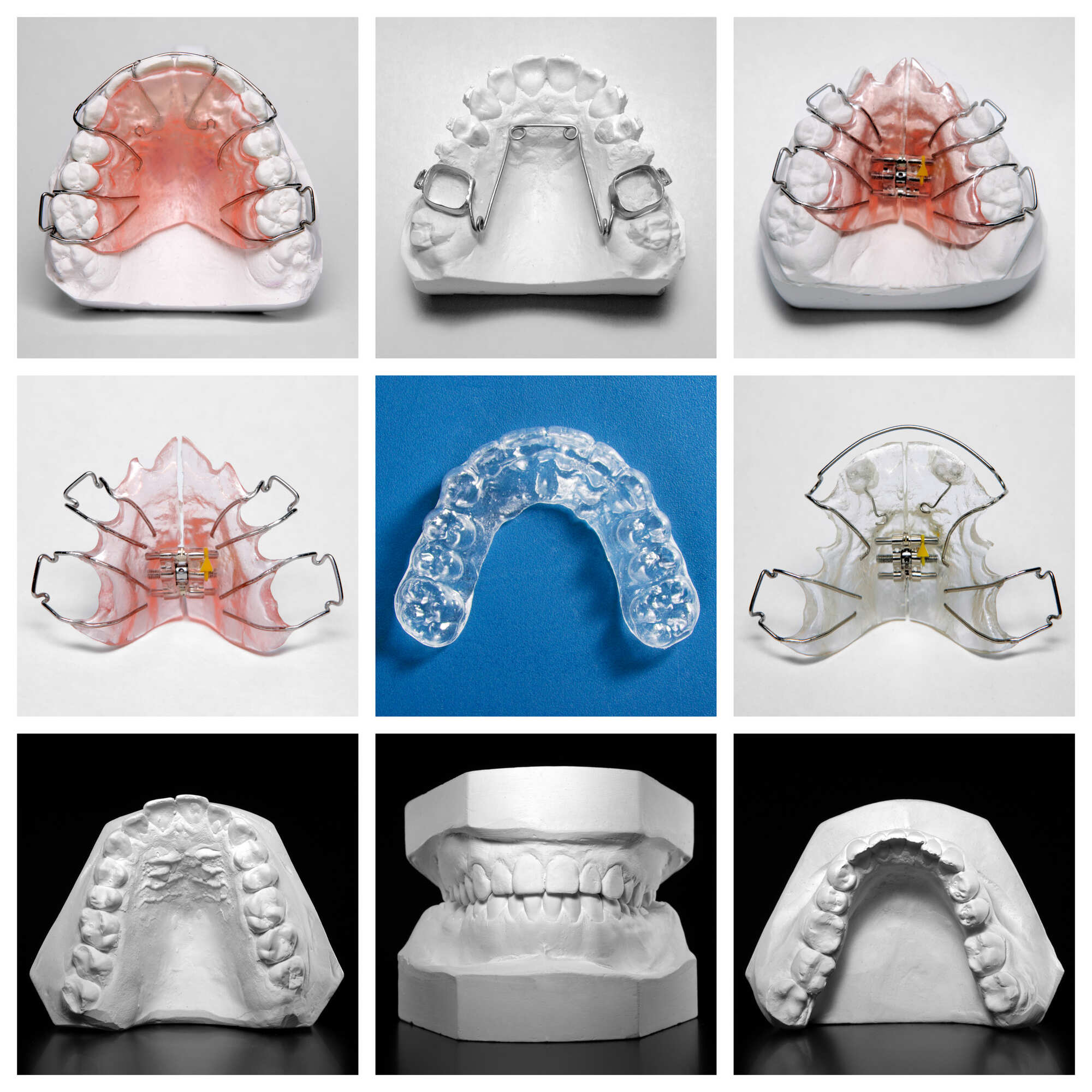 Collage featuring various types of orthodontic retainers
